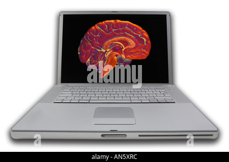 LAP TOP computer portatile con schermo di visualizzazione di falsa immagine a colori della fetta attraverso il cervello umano Foto Stock