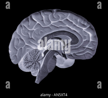 X RAY XRAY immagine a raggi X della metà sinistra del cervello umano Foto Stock