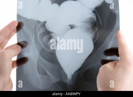 Un medico esamina un x ray scan Foto Stock