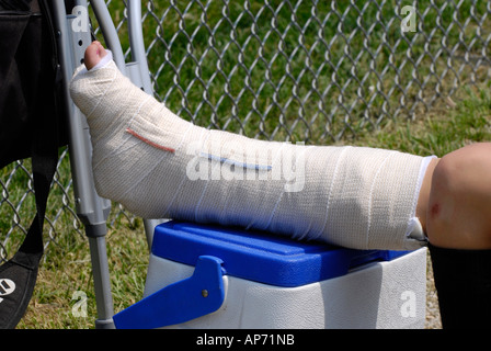 Femmina lettore softball distorsioni della caviglia sport da lesioni dovute a giocare a baseball Foto Stock