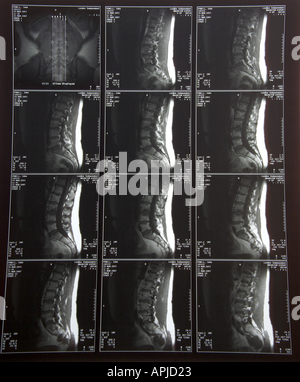 3436 Raggi X 7 scansioni MRI Modello rilasciato Foto Stock