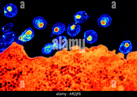 TEM al microscopio elettronico a trasmissione del virus dell AIDS Foto Stock