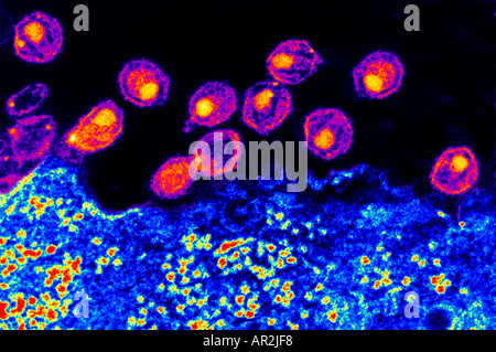 TEM al microscopio elettronico a trasmissione del virus dell AIDS Foto Stock