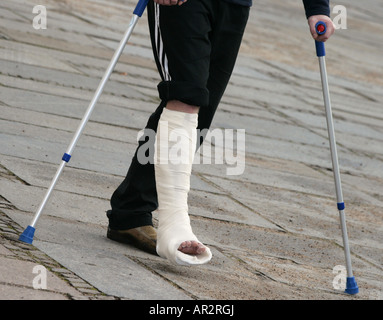 Uomo con due stampelle e una gamba in cast, Germania Foto Stock