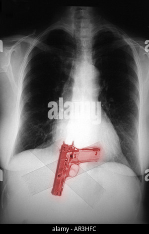 Simulazione di controlli di sicurezza in aeroporto a raggi X che mostra un celato Smith and Wesson 9mm pistola nastrato per una persona della vita Foto Stock