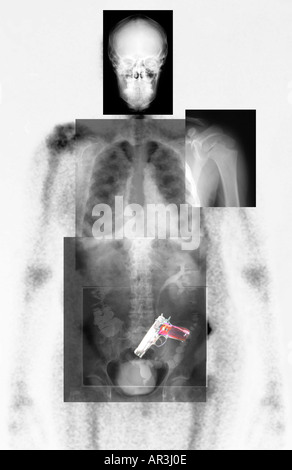 Simulazione di controlli di sicurezza in aeroporto a raggi X che mostra una Smith e Wesson 9mm pistola sovrapposto clinical lastre Foto Stock