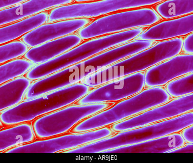 Onion skin in sezione trasversale al microscopio (Vista) Foto Stock