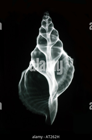 X-Ray foto di gasteropoda shell. Foto Stock
