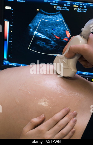 Una donna con una scansione a ultrasuoni Foto Stock