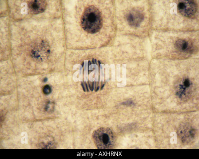 La mitosi (Anaphase) nel tessuto di cipolla a 1000x sotto microscopio ottico. olio inmersion Obiettivo 100x Foto Stock