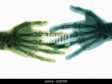 Stretta di mano dopo accordo x ray delle mani Foto Stock