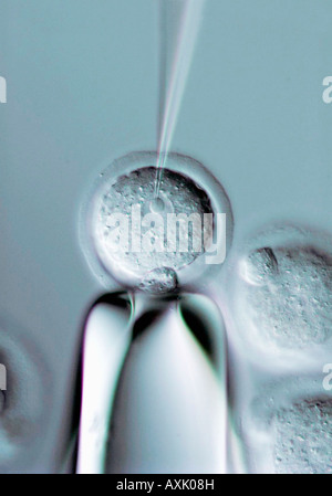 Clonazione di microiniezione embrionale umano cellule staminali cellule ES in cellula uovo fecondato Foto Stock