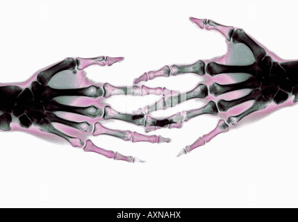 Stretta di mano dopo accordo x ray delle mani Foto Stock