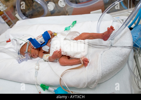 Bambino prematuro in un incubatore Foto Stock