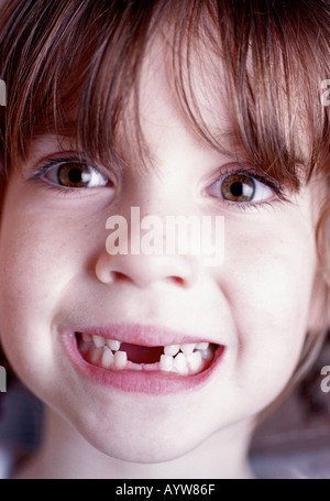 Una giovane ragazza che mostra la sua anteriore mancanti due denti superiori e inferiori Foto Stock