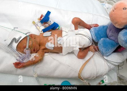 Bambino prematuro in un incubatore in una unità di terapia intensiva neonatale Foto Stock