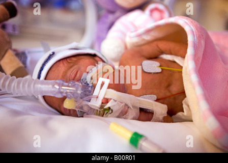 Prematura della unità di terapia intensiva neonatale (NICU) Foto Stock