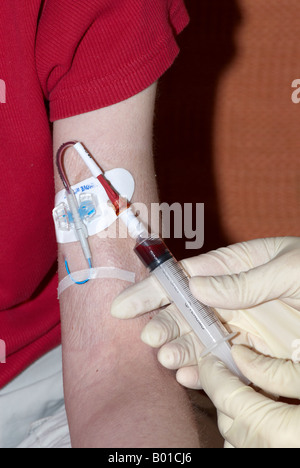 Prelievo di sangue da un picc line i cateteri inseriti centralmente perifericamente con una siringa e indossando i guanti chirurgici Foto Stock