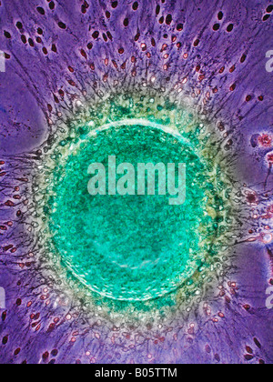 Sperma umano fecondare le cellule uovo fecondato Foto Stock