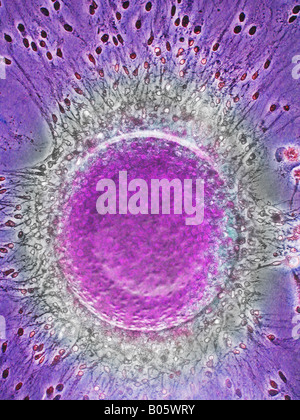 Sperma umano fecondare le cellule uovo fecondato Foto Stock