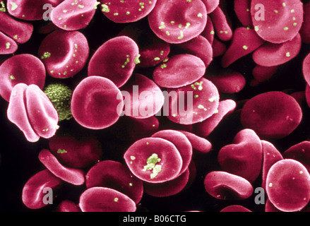 Le cellule rosse del sangue al microscopio elettronico a scansione Foto Stock
