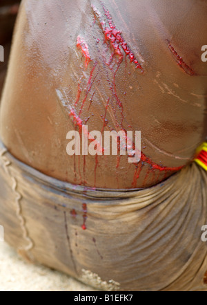 Le materie cicatrici su un Hamar donna torna dopo essere stata montata in corrispondenza di un "salto del Bull' cerimonia. Foto Stock