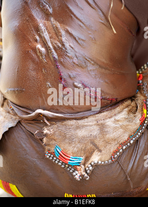 Le materie cicatrici su un Hamar donna torna dopo essere stata montata in corrispondenza di un "salto del Bull' cerimonia. Foto Stock
