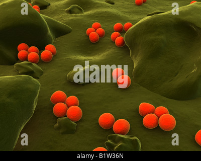 Neisseria gonorrhoeae