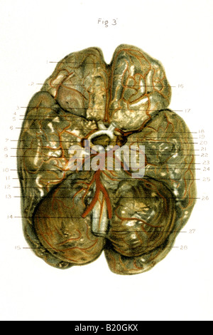 Immagine base delle arterie cerebrali circolo di Willis Foto Stock