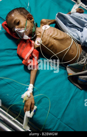 Poco Rotique, 9, è gravemente malato con TBand è stato preso per il reparto cure intensive di Shree ospedale di Jain al costo Foto Stock