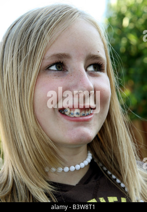 Piuttosto, 12 anni ragazza bionda con la sua nuova parentesi graffe, 2006 Foto Stock