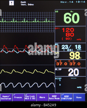 Un monitor medicale Foto Stock