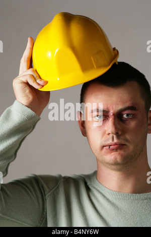 "Modello maschile James con un falso occhio nero applicato da make up artist e indossa un elmetto" Foto Stock
