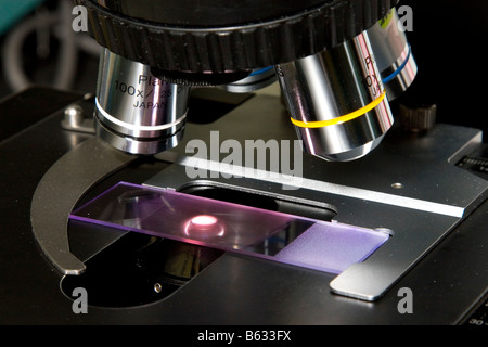 Microscopio in un laboratorio ospedaliero che mostra la lente obiettivo e una diapositiva con il sangue di un paziente. Foto Stock