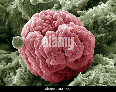 Rene glomerulus, colorata di microfotografia electron scansione (SEM). Cellule Podocyte Foto Stock
