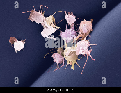 Piastrine attivate, colorata di microfotografia electron scansione (SEM). Queste cellule sono coinvolte nella coagulazione del sangue. Foto Stock