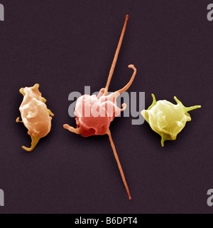 Piastrine attivate, colorata di microfotografia electron scansione (SEM). Queste cellule sono coinvolte nella coagulazione del sangue. Foto Stock