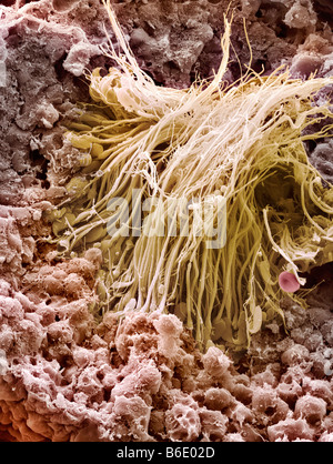 La produzione di sperma sito, colorata di microfotografia electron scansione (SEM) che mostra cellule spermatiche in un tubulo seminifero del testicolo. Foto Stock