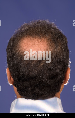Vista posteriore di un uomo calvo Foto Stock