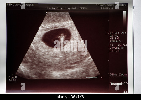 Una fotografia di un ultrasuono di sette settimane vecchio feto / baby Foto Stock