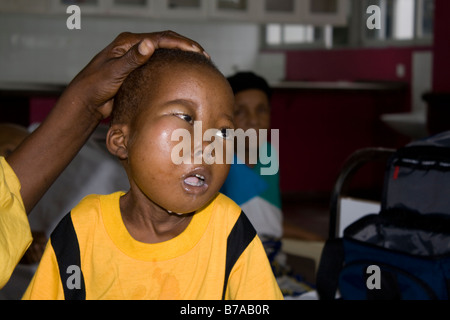 Bambino africano con cancro Burkitts childrens ward Mombasa Ospedale costa del Kenya Foto Stock