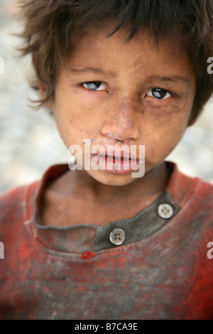 Trascurato cinque anni ragazzo Nepalise Sunil Foto Stock