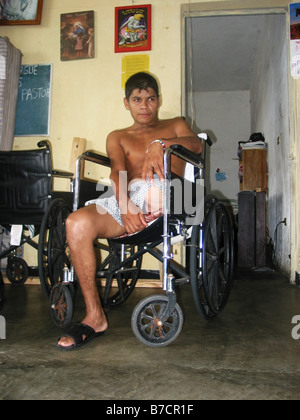 Immigrato clandestino, attaccato sulla deathtrain, con gambe amputate seduto in una sedia a rotelle in ospizio El Buen Pastor in Tapachul Foto Stock
