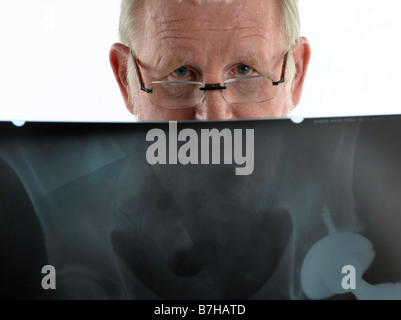 Medico con XRAY CERCANDO DI FOTOCAMERA Foto Stock