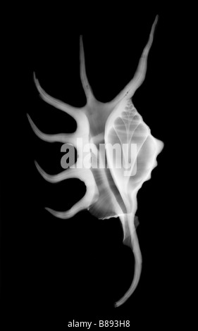 X ray di un ragno Conch Strombidi sp shell Foto Stock