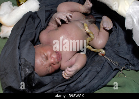 Nigeriano neonato bambino africano erogata mediante taglio cesareo in un ospedale della comunità Foto Stock