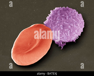 Le cellule del sangue. Color scanning electron microfotografia (SEM) di un globulo rosso umano (degli eritrociti, rosso)e una delle cellule bianche del sangue. Foto Stock