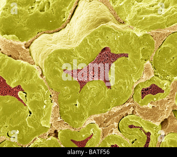 Le fibre nervose. Color scanning electronmicrograph (SEM) di fractured mielinizzate nervefibers. Foto Stock