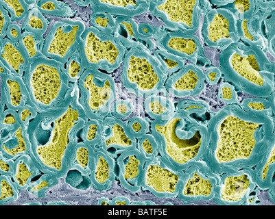 Le fibre nervose. Color scanning electronmicrograph (SEM) di fractured mielinizzate nervefibers Foto Stock