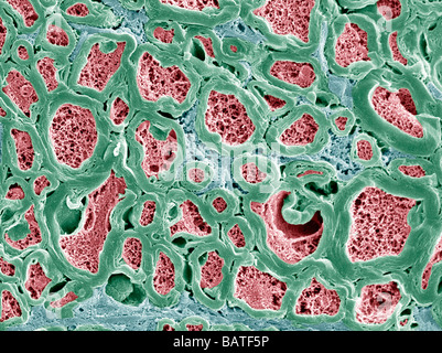 Le fibre nervose. Color scanning electronmicrograph (SEM) di fractured mielinizzate nervefibers Foto Stock